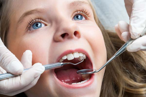How Dental Sealants Can Protect Your Child’s Teeth